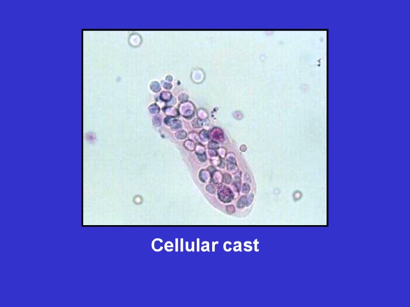 Cellular cast
